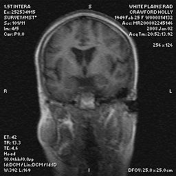 brain0005.jpg