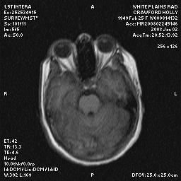 brain0006.jpg