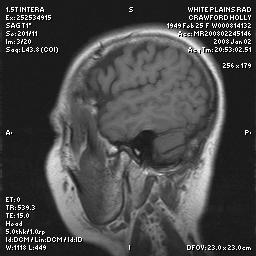 brain0009.jpg