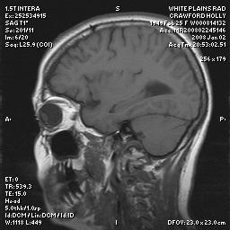 brain0012.jpg