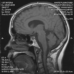 brain0016.jpg