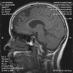 brain0018.jpg