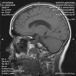 brain0019.jpg