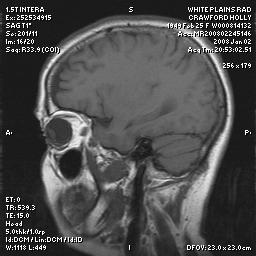 brain0022.jpg
