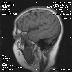 brain0024.jpg