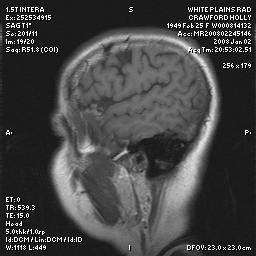 brain0025.jpg