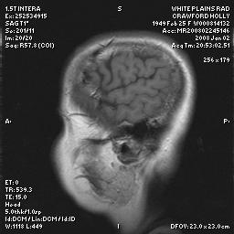 brain0026.jpg